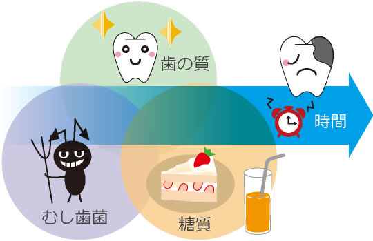 むし歯の要因